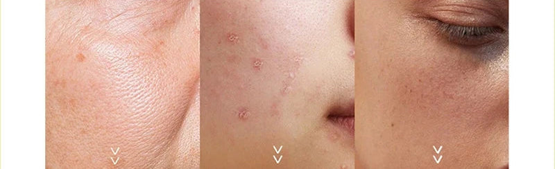 GLAMIXIR Collagen Glow Mask™ – Pack de 10 masques hydratants au collagène